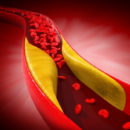 Lipids