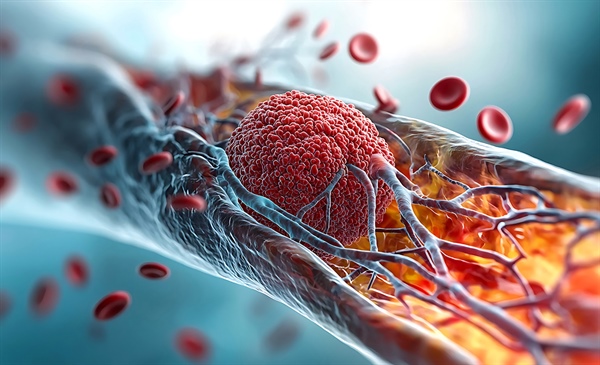 Apixaban may outperform rivaroxaban and warfarin for VTE treatment